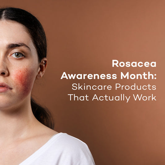 Rosacea Awareness Month: Skincare Products That Actually Work