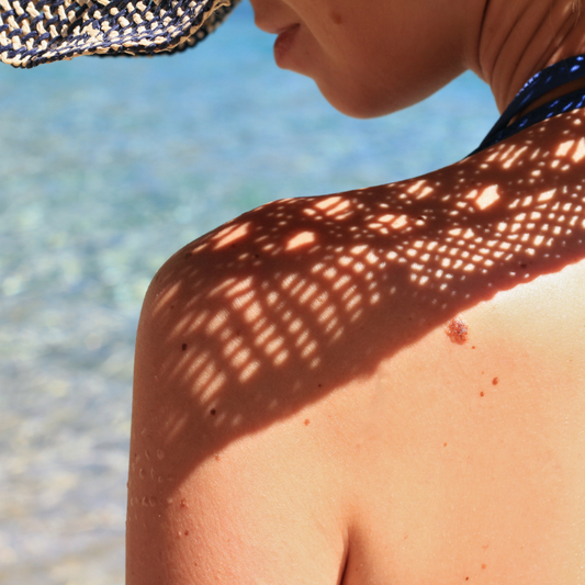 Don’t Let Hyperpigmentation Hold You Back this Summer